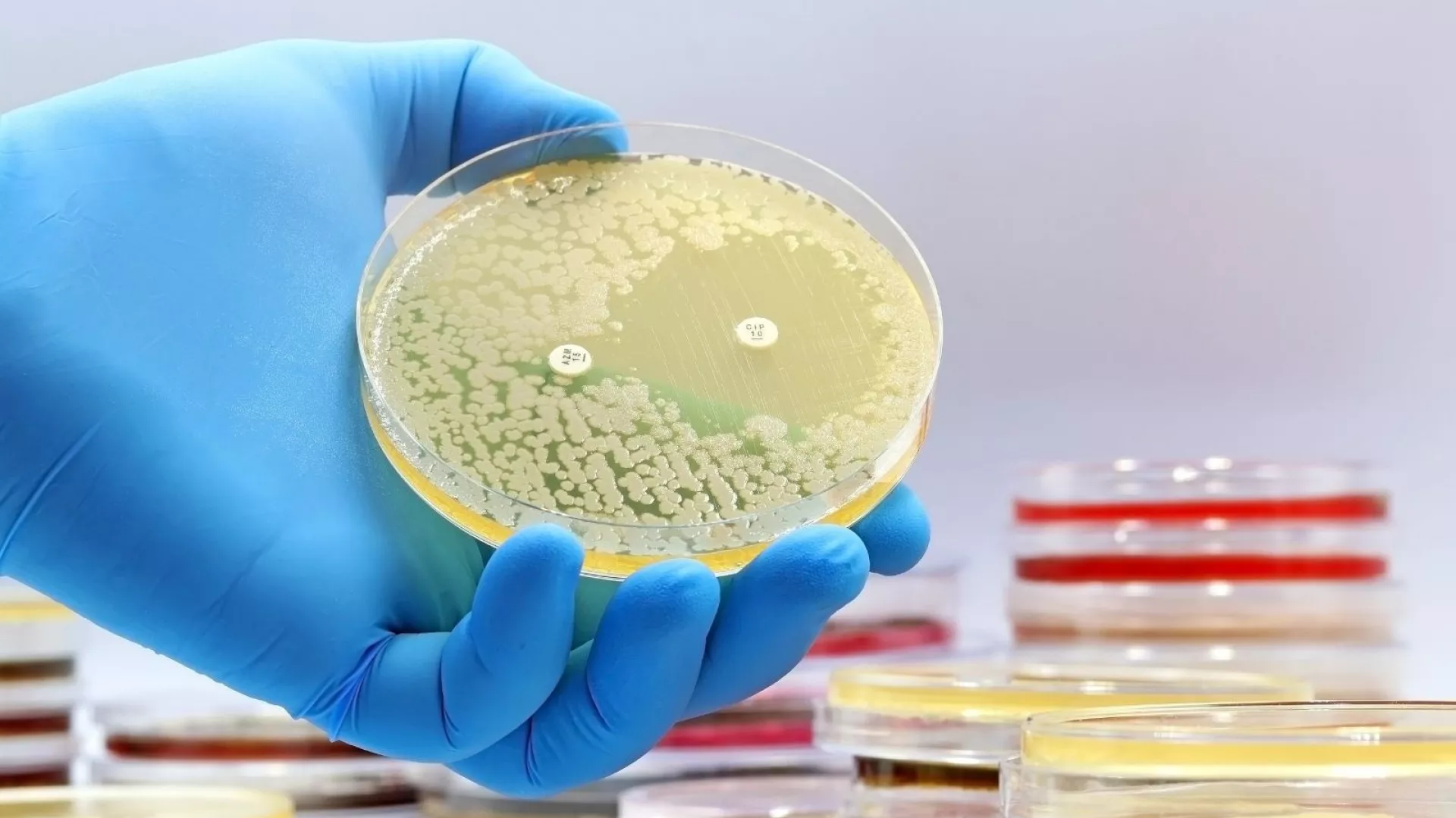 Novos Antibióticos Descobertos pela IA: Uma Revolução na Medicina Moderna Novos Antibióticos Descobertos pela IA: Uma Revolução na Medicina Moderna
